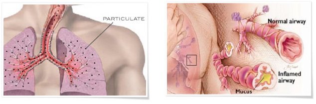 Laser Generated Airbourne Contaminates - LGAC